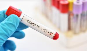 Groundbreaking London research could help develop COVID-19 treatments