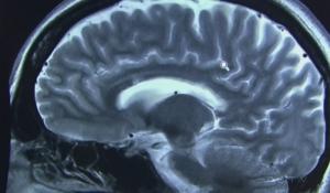 London Scientists Secure Federal Funding to Gain New Insights Into Brain Disease